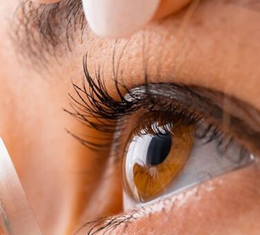 لنز اسکلرال، تحول جدید بینایی برای درمان عیوب انکساری چشم