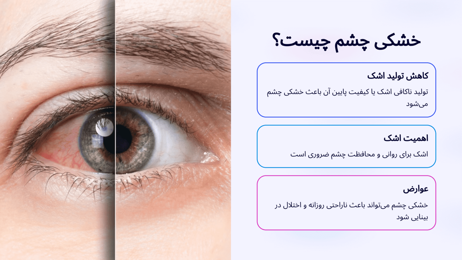 👁️ خشکی چشم چیست؟