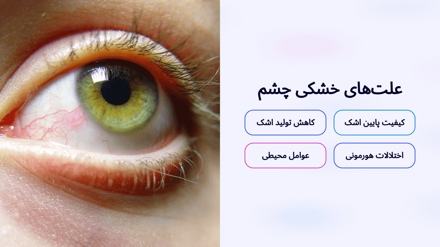 🧩 علتهای اصلی خشکی چشم (فارغ از موبایل و کامپیوتر)