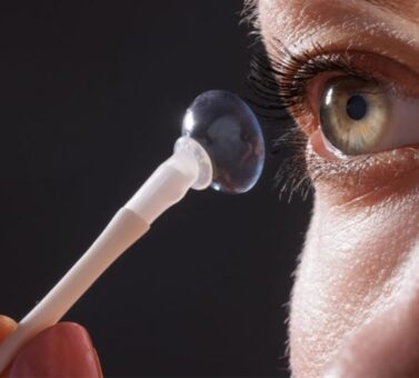 لنز اسکلرال: راه‌حل نهایی برای قوز قرنیه، خشکی چشم شدید و بینایی واضح