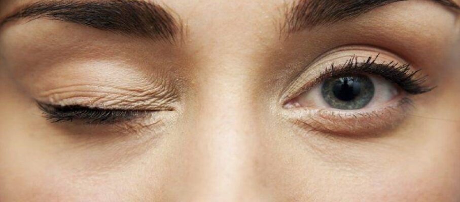 نیستاگموس (لرزش چشم): راهنمای علمی و جامع برای تشخیص و درمان