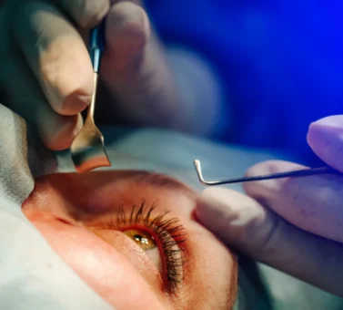 تخلیه چشم چیست و همه آنچه باید درباره جراحی، پروتز و مراقبت‌های پس از آن بدانید | راهنمای جامع و علمی