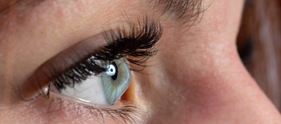 درمان خانگی قوز قرنیه چشم: ۸ روش طبیعی برای مدیریت علائم + راهنمای جامع