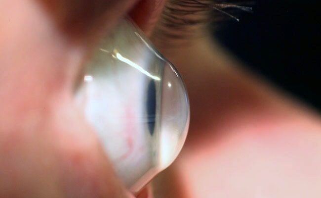 👁️قوز قرنیه (کراتوکونوس): از علائم و تشخیص تا جدیدترین روش‌های درمان