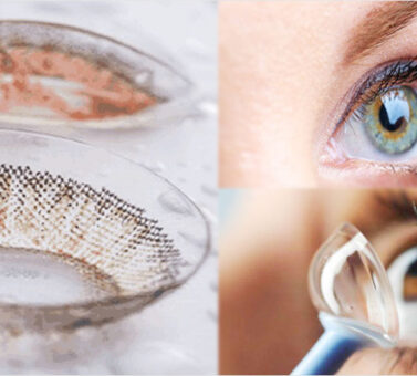 لنز اسکلرال چیست؟ یک راهنمای جامع از مزایا تا معایب و هزینه