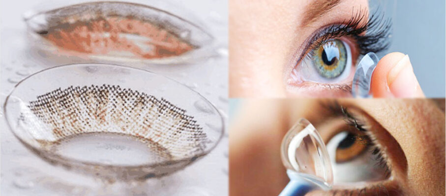 لنز اسکلرال چیست؟ یک راهنمای جامع از مزایا تا معایب و هزینه