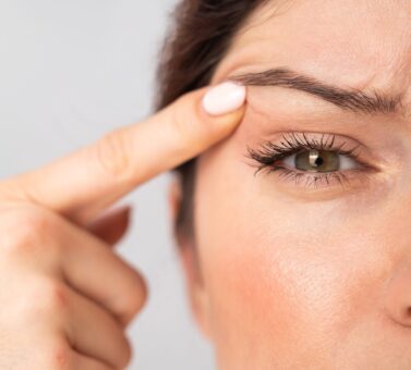 علت، علائم و درمان پرش پلک چشم (تیک عصبی چشم) | راهنمای علمی و جامع