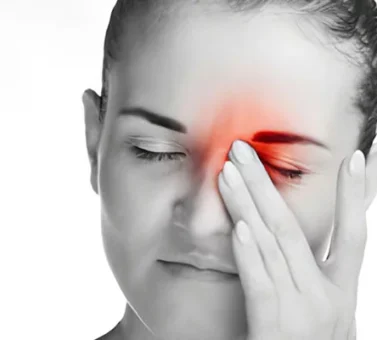 درمان میگرن چشمی در خانه: راهنمای جامع مدیریت و پیشگیری