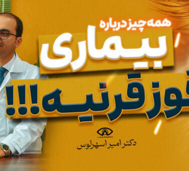 قوز قرنیه چیست و چگونه درمان می‌شود؟