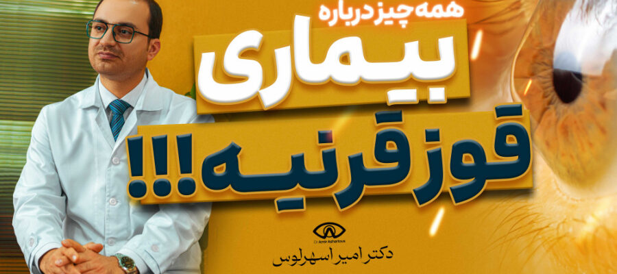 قوز قرنیه چیست و چگونه درمان می‌شود؟