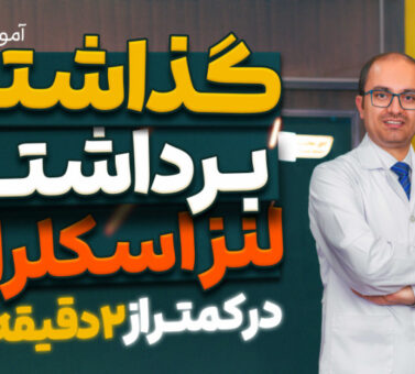 آموزش گذاشتن و برداشتن لنز اسکلرال