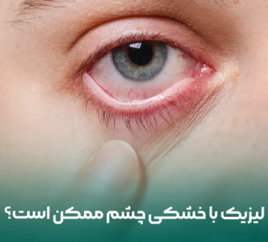 آیا با وجود خشکی چشم می‌توان عمل لیزیک انجام داد؟