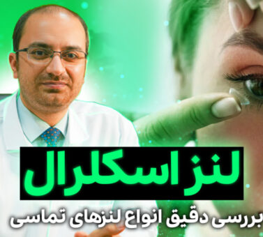 مقایسه کامل لنزهای تماسی نرم، هارد و اسکلرال