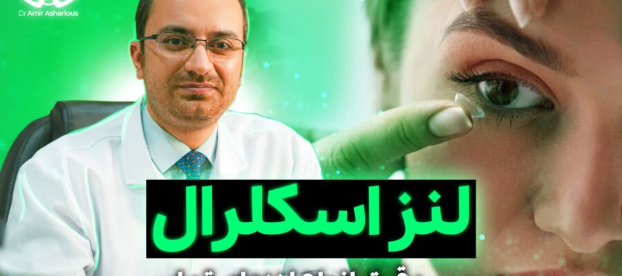 مقایسه کامل لنزهای تماسی نرم، هارد و اسکلرال