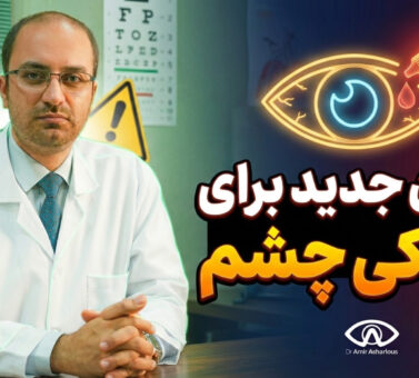 درمان جدید برای خشکی چشم