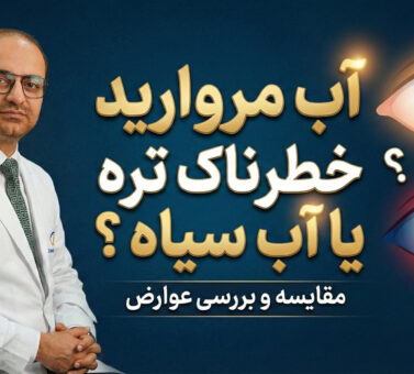آب مروارید خطرناک تره یا آب سیاه ؟