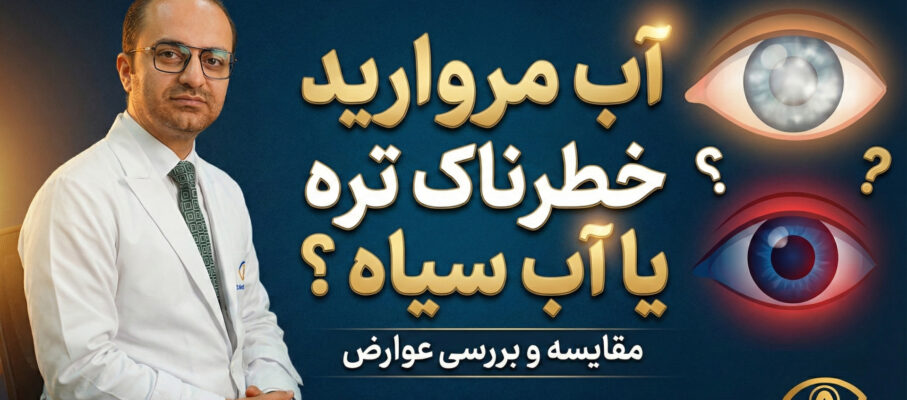 آب مروارید خطرناک تره یا آب سیاه ؟