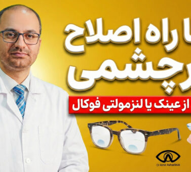 تنها راه اصلاح پیرچشمی
