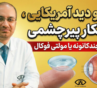 لنز دو دید آمریکایی ، شاهکار پیرچشمی