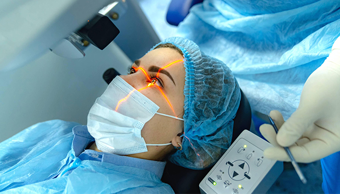 عمل لیزیک چشم آستیگمات