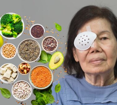 خانه داری و آشپزی بعد از عمل آب مروارید