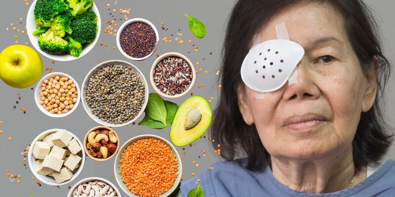 خانه داری و آشپزی بعد از عمل آب مروارید